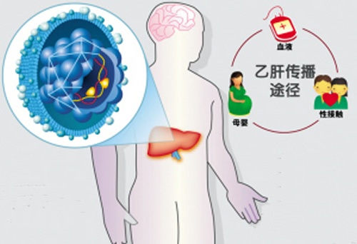 乙肝的传播途径有哪些？